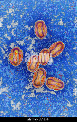 POX VIRUS, TEM Stock Photo