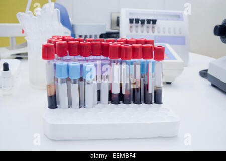 Close up of blood samples in test tube rack in laboratory Stock Photo
