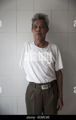 Buiv Van Ha fought in Hue province, lost his arm during a bombing. It is also affected by Agent Orange dioxin. Stock Photo