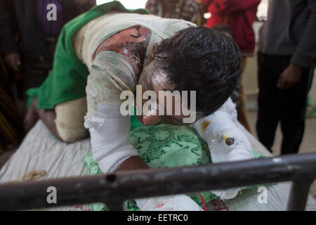 Dhaka, Bangladesh. 21st January, 2015. Auto rickshaw driver Abdur Rashid 40 screaming suffer of burn injuries from an attack on a bus during a nationwide strike called by the Bangladesh Nationalist Party (BNP)-led alliance, recuperates at Dhaka Medical College Hospital (DMCH). Credit:  zakir hossain chowdhury zakir/Alamy Live News Stock Photo