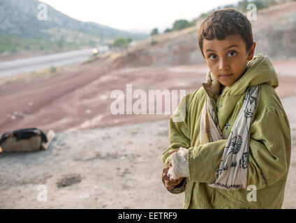 Wounded Yezedi Refugee Child Displaced From Sinjar, Duhok, Kurdistan, Iraq Stock Photo
