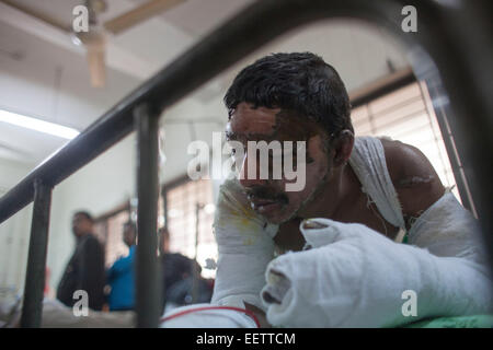 Dhaka, Bangladesh. 21st January, 2015. Auto rickshaw driver Abdur Rashid 40 screaming suffer of burn injuries from an attack on a bus during a nationwide strike called by the Bangladesh Nationalist Party (BNP)-led alliance, recuperates at Dhaka Medical College Hospital (DMCH). Credit:  zakir hossain chowdhury zakir/Alamy Live News Stock Photo