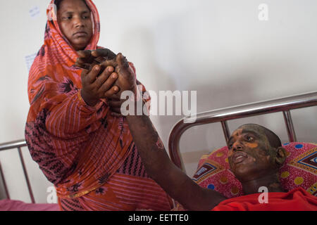 Dhaka, Bangladesh. 21st January, 2015. Masum 15 suffering burn injuries from an attack on a bus during a nationwide strike called by the Bangladesh Nationalist Party (BNP)-led alliance, recuperates at Dhaka Medical College Hospital (DMCH). Credit:  zakir hossain chowdhury zakir/Alamy Live News Stock Photo