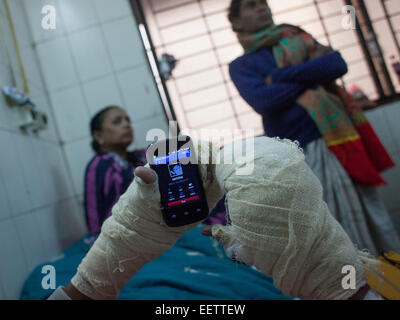 Dhaka, Bangladesh. 21st January, 2015. Prithiraj Chakraborti 22 suffering burn injuries from an attack on a bus during a nationwide strike called by the Bangladesh Nationalist Party (BNP)-led alliance, recuperates at Dhaka Medical College Hospital (DMCH). Credit:  zakir hossain chowdhury zakir/Alamy Live News Stock Photo