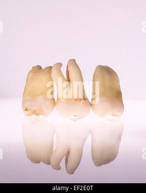 Healthy extracted wisdom tooth with one root Stock Photo - Alamy