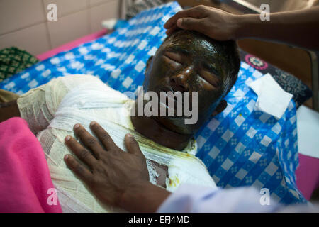 Dhaka, Bangladesh. 05th Feb, 2015. Shafiqul Islam, 18, one of the victims of petrol bomb attack on a bus cries in pain as he receives treatment at the Dhaka Medical College hospital. Attackers threw crude fire bombs at a packed bus early Tuesday morning, the incident happened in Comilla's Choudyagram area. The firebombing was reported on the Dhaka-Chittagong highway around 3.30 am amid the ongoing BNP transport blockade and the three day nationwide strike. Seven passengers were burnt alive because they could not get out of the bus and at least twenty five passengers were injured, ten of them w Stock Photo