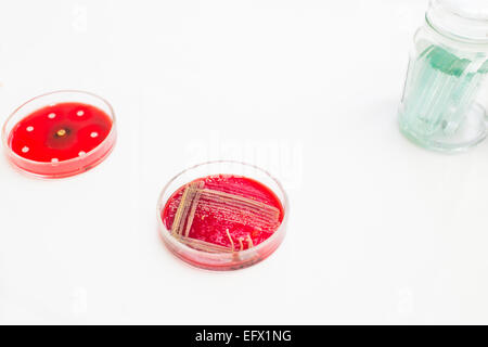 Two Petri dishes with bacteria growing in them Stock Photo