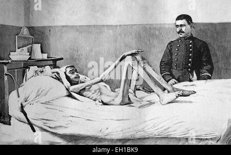 Famine in Algeria, a man rescued from starvation in the hospital of Milianah, historical illustration circa 1893 Stock Photo