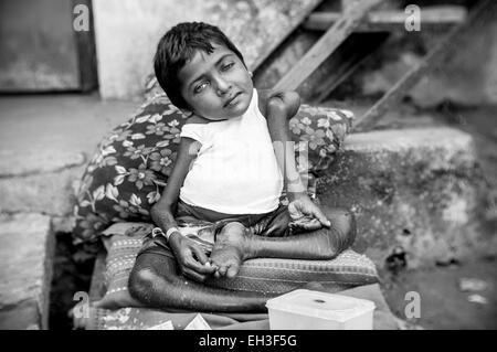 A small homeless girl, severely disabled, begging for money in rural India. Stock Photo
