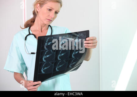 Doctor examining x-ray Stock Photo