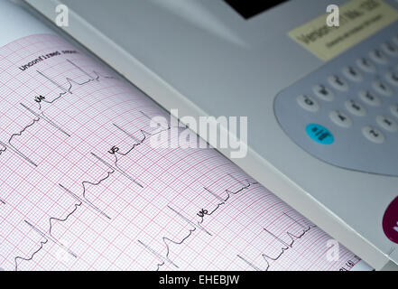 Electrocardiogram. Stock Photo