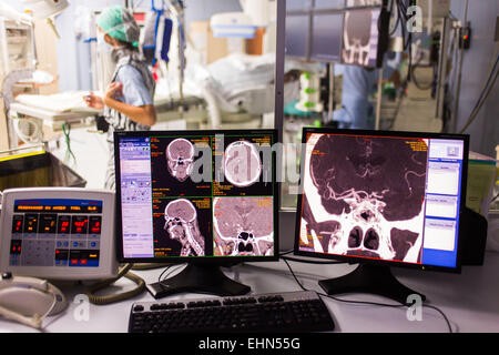 Thrombectomy performed under cerebral angiography on a patient with ...