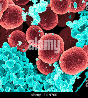 Coloured scanning electron micrograph (SEM) of methicillin-resistant Staphylococcus aureus (MRSA) bacteria.