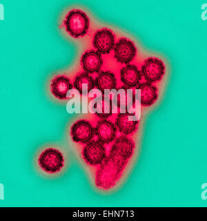 H1N1 influenza virus particle, Transmission Electron Micrograph (TEM). Stock Photo