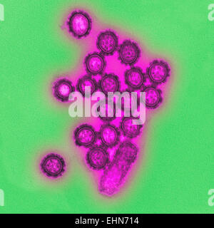 H1N1 influenza virus particle, Transmission Electron Micrograph (TEM). Stock Photo