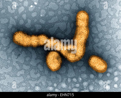 Transmission Electron Micrograph (TEM) depicts numbers of H1N1 influenza virus particles.