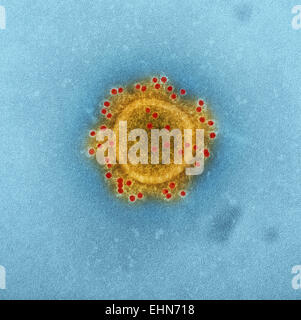 Coloured transmission electron micrograph (TEM) of a MERS coronavirus particle , this virus (originally novel coronavirus 2012) has been named Middle East respiratory syndrome (MERS) coronavirus. Stock Photo