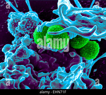 Coloured scanning electron micrograph (SEM) of methicillin-resistant Staphylococcus aureus (MRSA) bacteria.