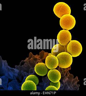 Coloured scanning electron micrograph (SEM) of a neutrophil white blood cell (bottom) engulfing methicillin-resistant Staphylococcus aureus bacteria (MRSA, yellow). Stock Photo