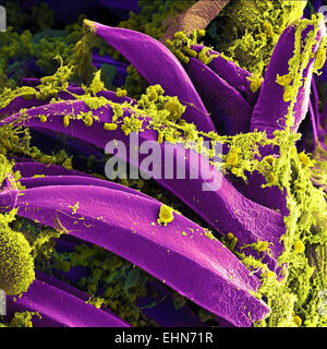 Yersinia pestis bacteria that had gathered on the proventricular spines of a Xenopsylla cheopis flea. The Y. pestis bacterium is the pathogen that causes bubonic plague, scanning electron micrograph (SEM). Stock Photo