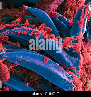 Yersinia pestis bacteria that had gathered on the proventricular spines of a Xenopsylla cheopis flea. The Y. pestis bacterium is the pathogen that causes bubonic plague, scanning electron micrograph (SEM). Stock Photo