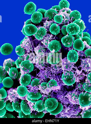 Coloured scanning electron micrograph (SEM) of Staphylococcus epidermidis bacteria embedded in an exopolysaccharide matrix . These Gram-positive cocci (spherical bacteria) are found on human skin. They are usually harmless, but are able to form biofilms o Stock Photo