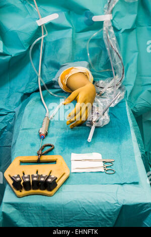 Arthroscopic wrist surgery, Jouvenet clinic, Paris, France. Stock Photo