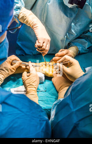 Carpal tunnel syndrome surgery, Jouvenet clinic, Paris, France. Stock Photo