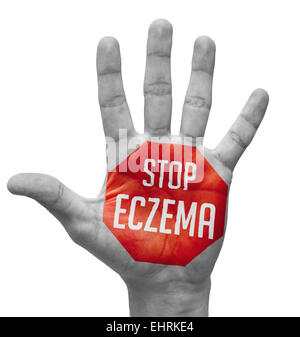 Stop Eczema Concept on Open Hand. Stock Photo