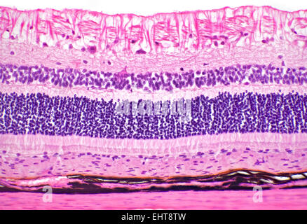 Brightfield photomicrograph of an eye retina section showing structure ...