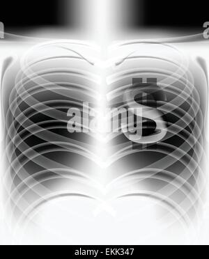 illustration of human x - ray film Stock Vector Image & Art - Alamy