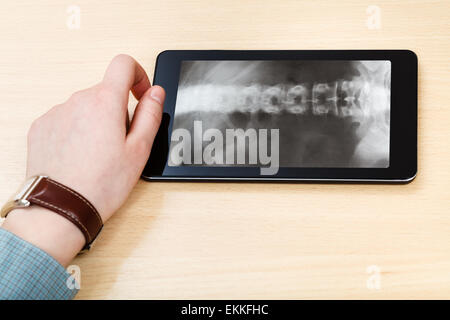 scientist analyzes X-ray picture of vertebral column on screen on tablet pc Stock Photo