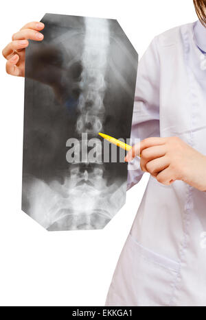 nurse shows X-ray picture with human spinal column isolated on white background Stock Photo