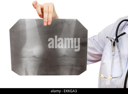 nurse holds X-ray picture with human knee joint isolated on white background Stock Photo