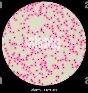 Chicken red blood cells under a microscope (blood smear Chicken), 400x Stock Photo