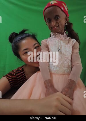 Quezon City, Philippines. 27th April, 2015. Young designer Amiel Avena creates the gown of progeria sufferer Rochelle Pondare for her 18th birthday celebration on May 30, 2015. Kids with progeria has life span of 13-15 years old only, but due to new medicines discovered to prolong the lives of kids affected with this rare genetic abnormality that causes fast aging, Pondare will reached eighteen next month to celebrate her debut party and she is looking forward to dance with her first love, Ricardo.  It's first time in the Philippines that a progeria sufferer can celebrate her womanhood. © Sher Stock Photo