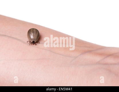 Tick crawling on a human skin. Stock Photo