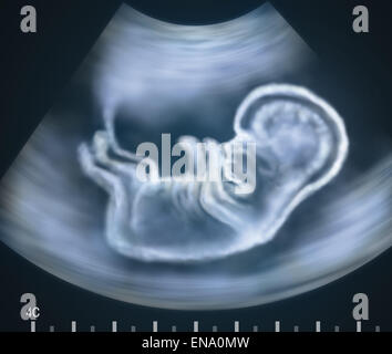 Ultrasound image of baby in mother's womb. Concept. Stock Photo