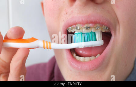 Teenage boy cleaning his teeth and braces with a brush close up Stock Photo