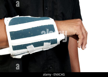 Broken Arm Stock Photo