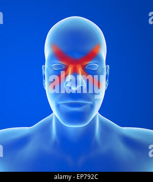 Type headache: Sinus pain is usually behind the forehead and cheekbones on blue background Stock Photo