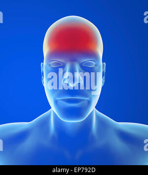 Type headache: Tension pain is like a band squeezing the head on blue background Stock Photo