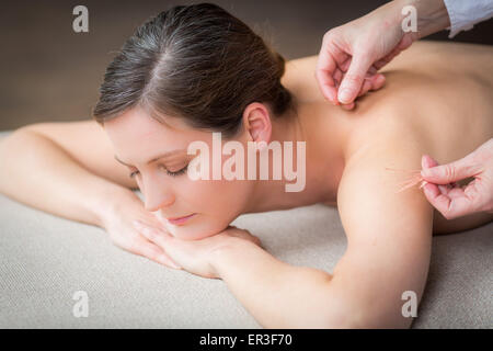 Woman receiving acupunture. Stock Photo