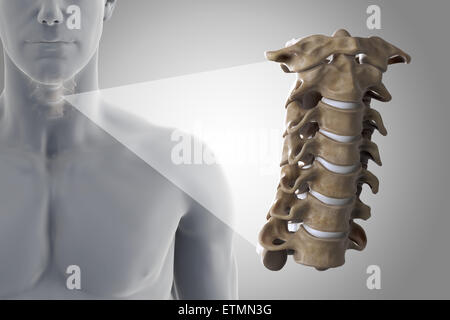 Stylized illustration showing the vertebrae of the neck in situ, with a zoomed out section to show the cervical vertebrae in more detail. Stock Photo