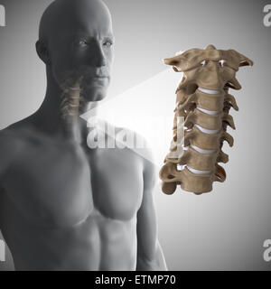 Stylized illustration showing the vertebrae of the neck in situ, with a zoomed out section to show the cervical vertebrae in more detail. Stock Photo