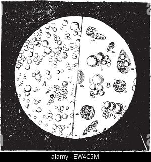 Milk seen under a microscope, vintage engraved illustration. Industrial encyclopedia E.-O. Lami - 1875. Stock Vector