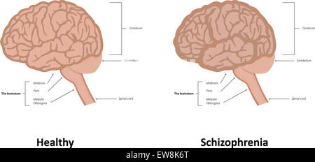 Schizophrenia Stock Photo