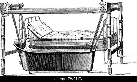 Dupoint device for transportation of sick patient from their bed in the bathtub, vintage engraved illustration. Usual Medicine D Stock Vector
