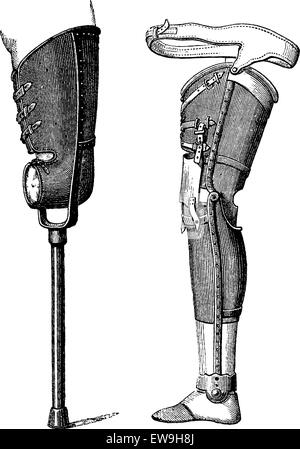 Private Charles Myer, Amputation of the Right Thigh, from the