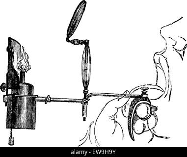 Portable Laryngoscope, illuminated by direct light from a gas lamp, used to examine a patient's mouth, vintage engraved illustra Stock Vector